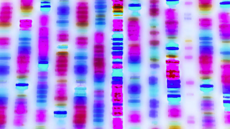 Element Biosciences Launches $100 Genome Sequencer