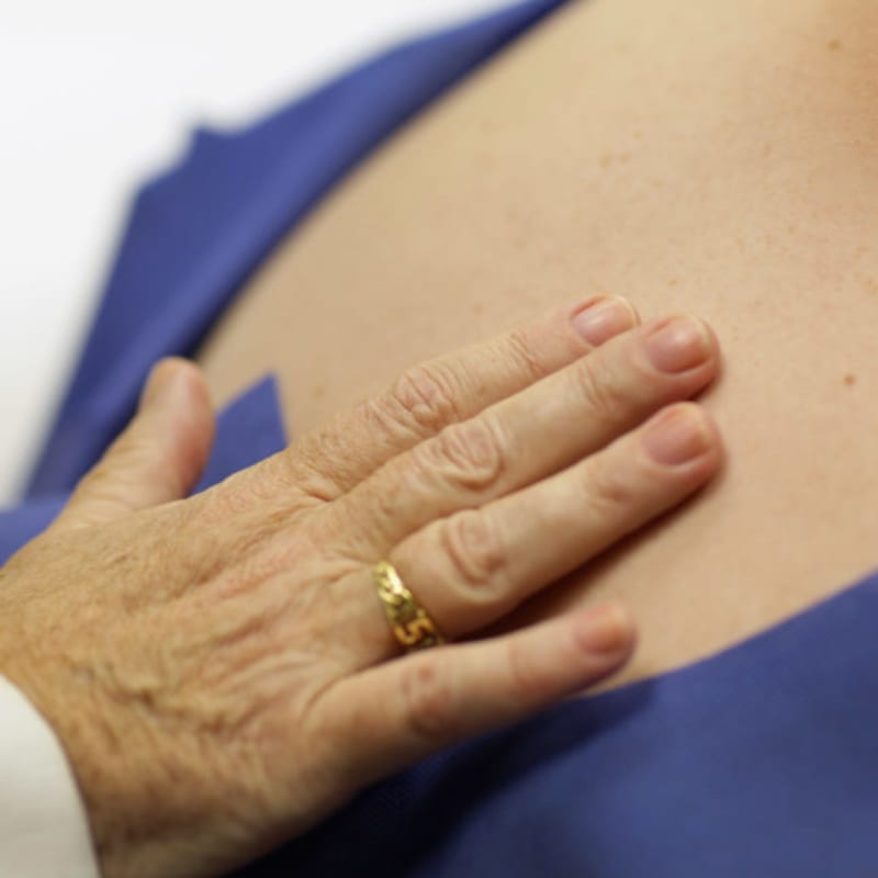 New Eczema Pill Shows 75% Success Rate in Early Trial - Image 2