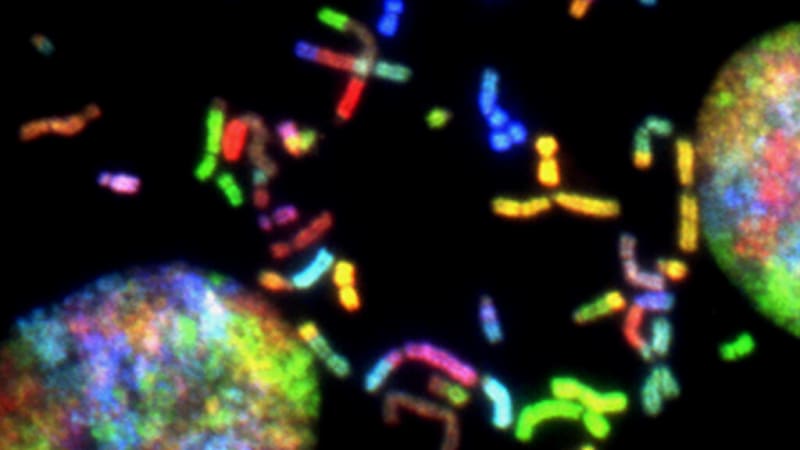 New Brain Cancer Therapy Shows Promise in First Patients