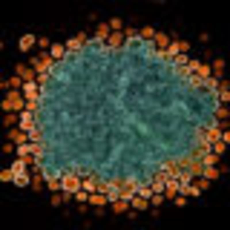 AI Team Designs Better Tools to Catch Memory Loss Early - Image 5
