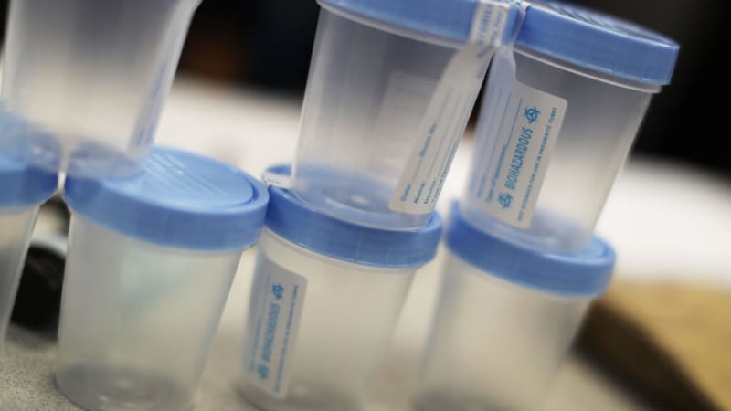 The Hidden Truth About Urinary Tract Infections in Seniors: What Doctors Need to Know