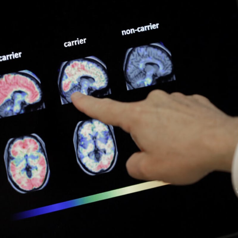 Alzheimer's Startup Raises $175M for New Brain Treatment - Image 2