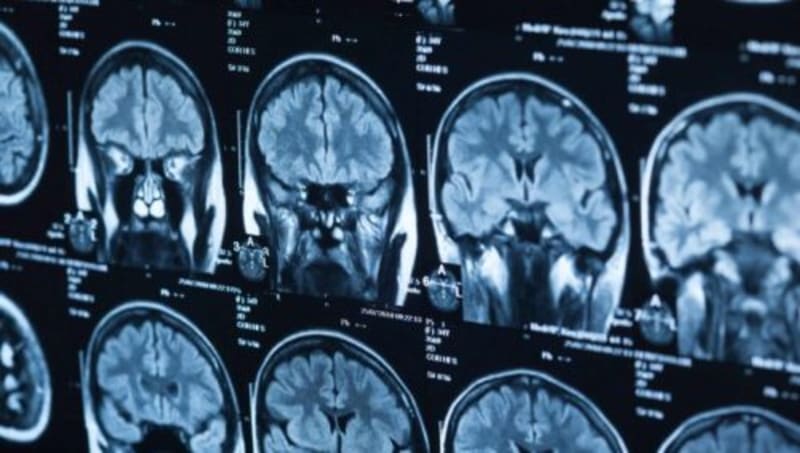 UK Pharma Gets Canadian Patent for Addiction Drug - Image 2