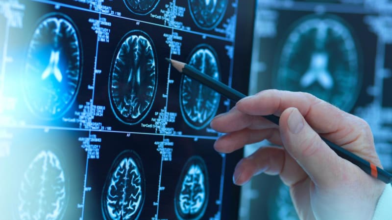 ** Scientist examining blood sample vials in laboratory for Alzheimer's disease protein research