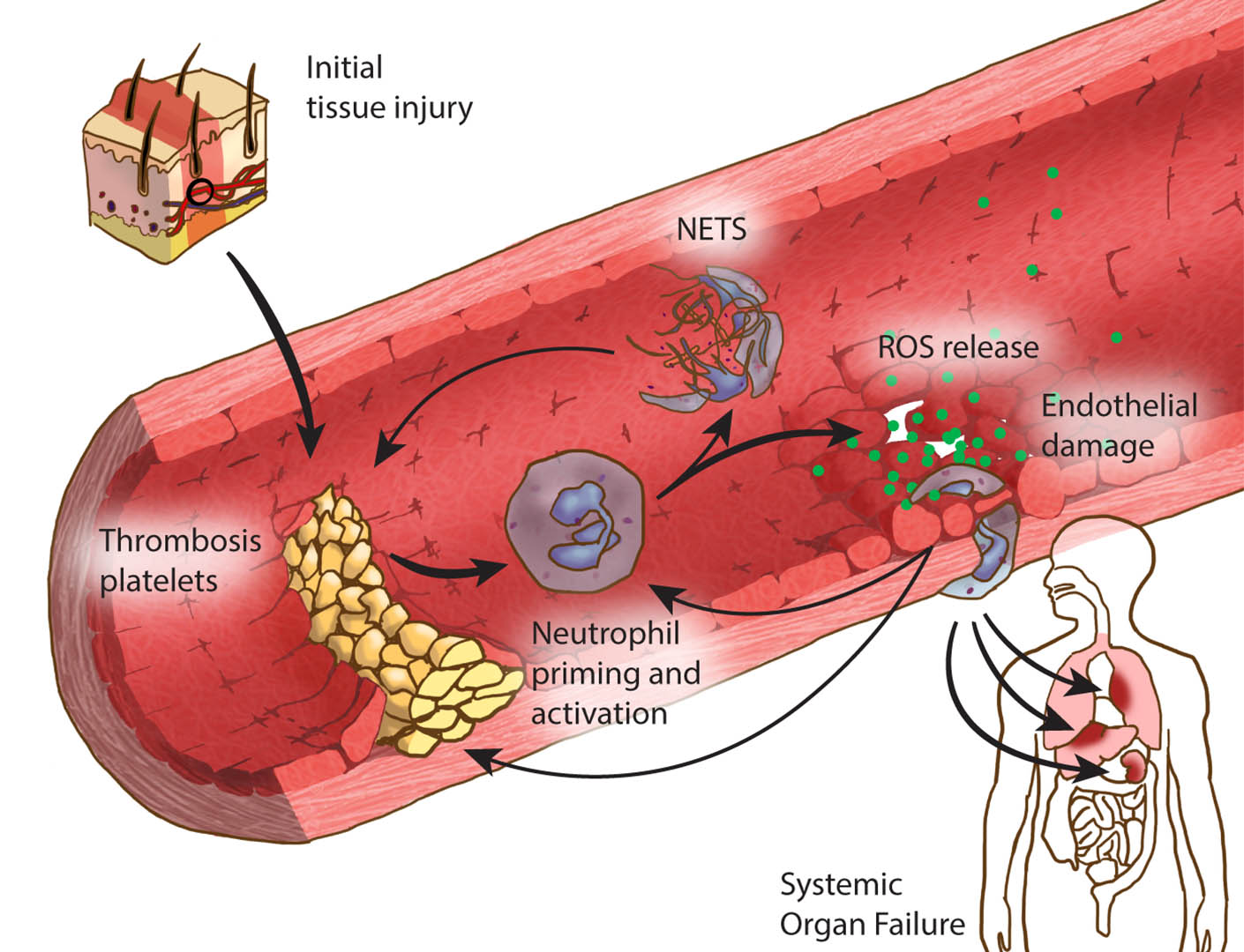 The Acute Innate Immune Response — scientific illustration