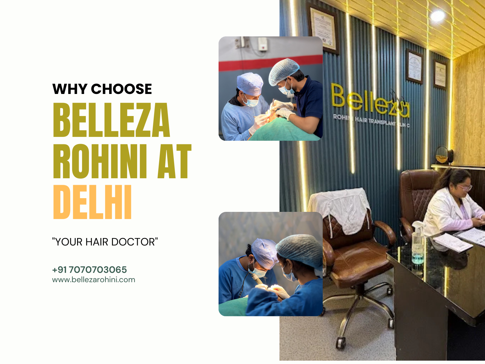 Hair transplant clinic in Rohini Delhi Delhi