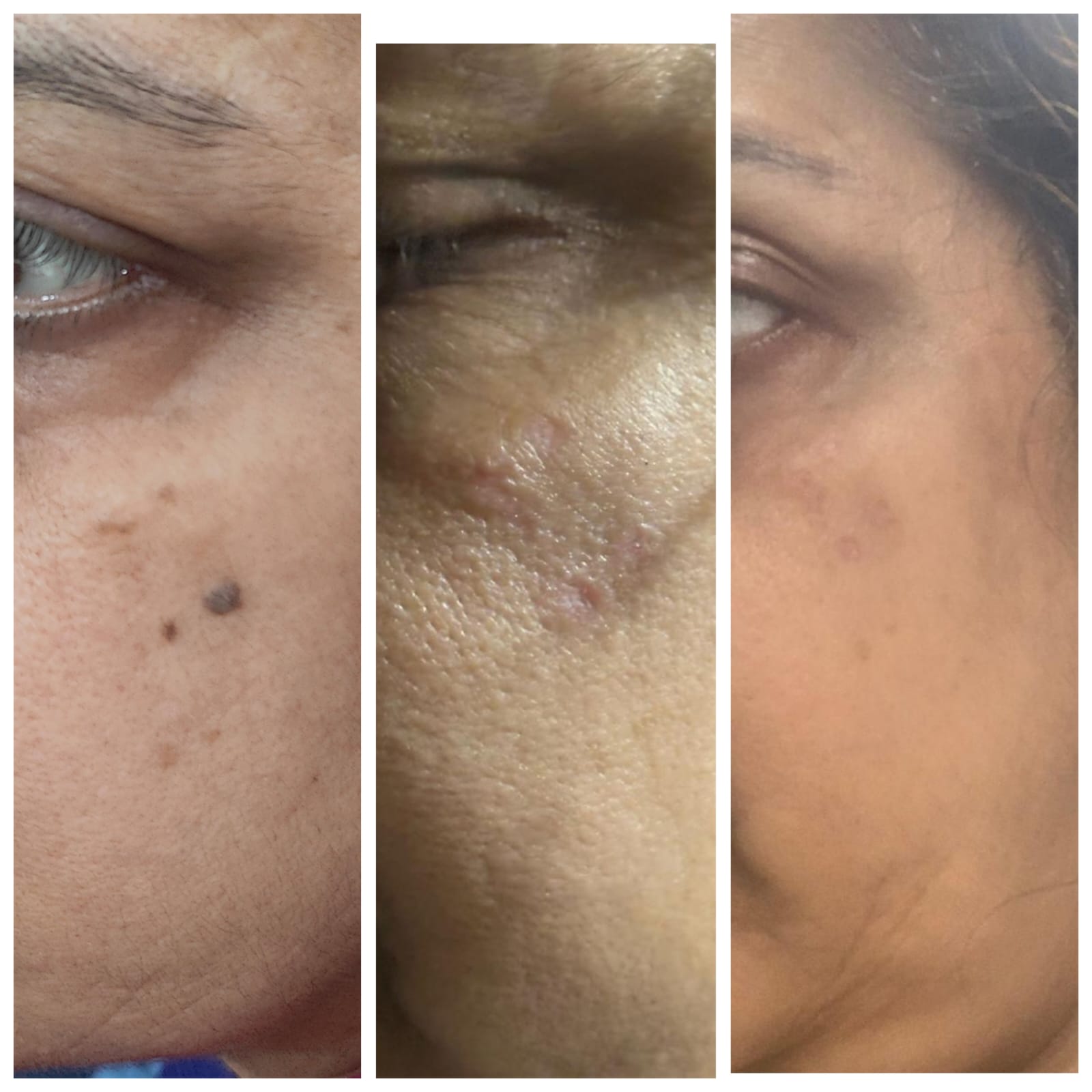 Before and after result 3