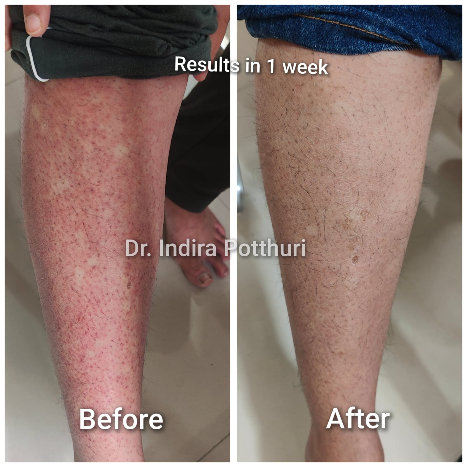Before and after result 1