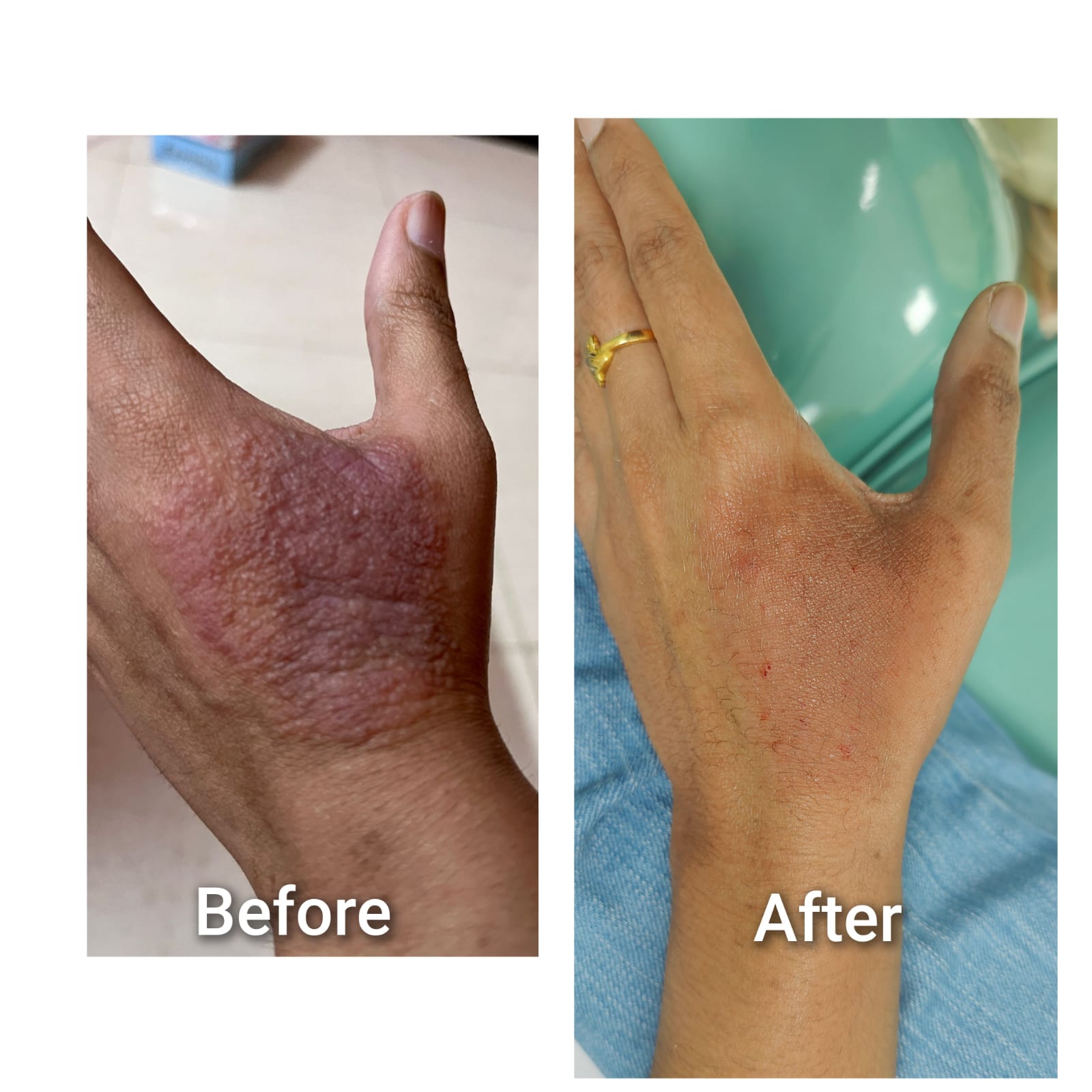 Before and after result 2