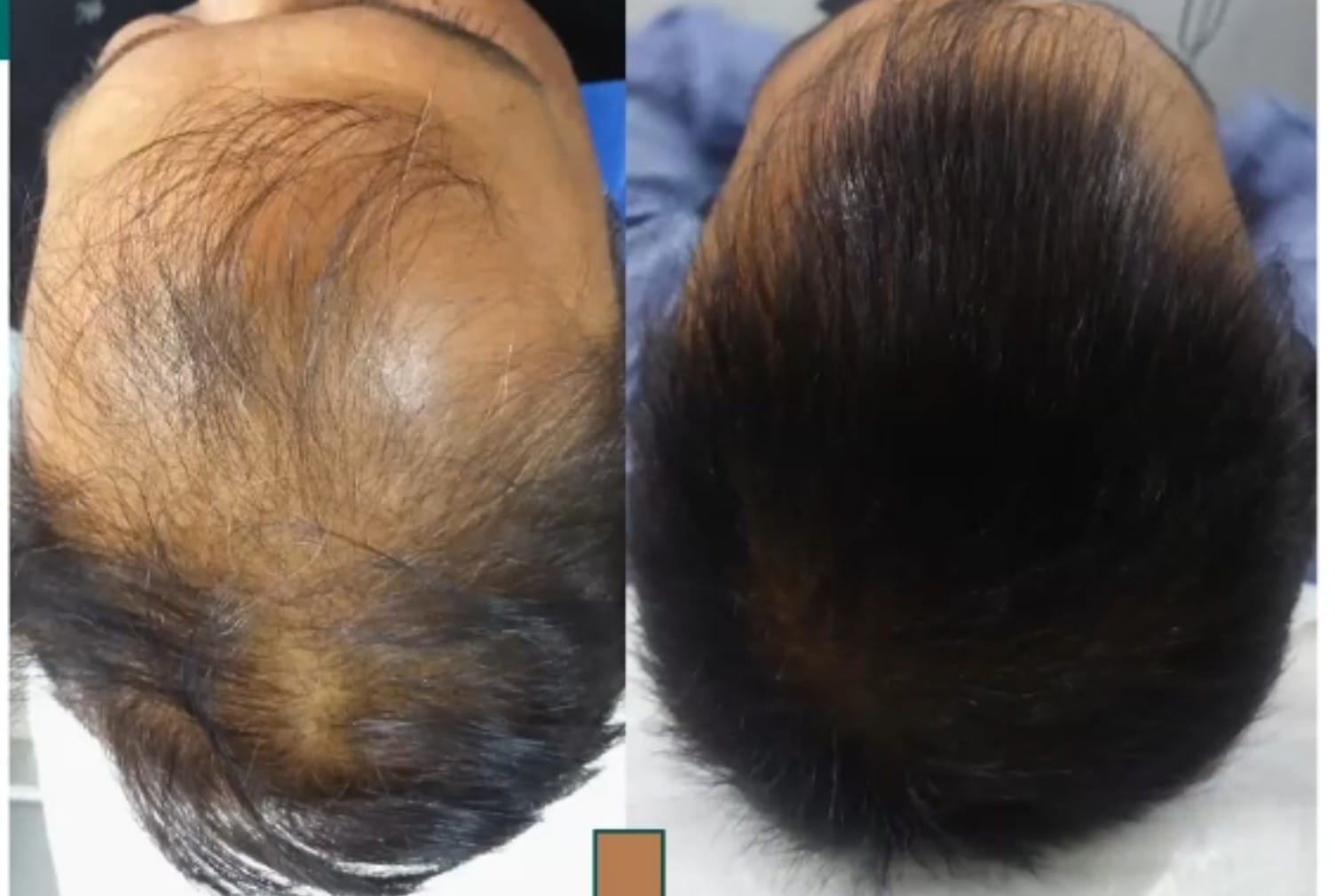 Hair treatment result