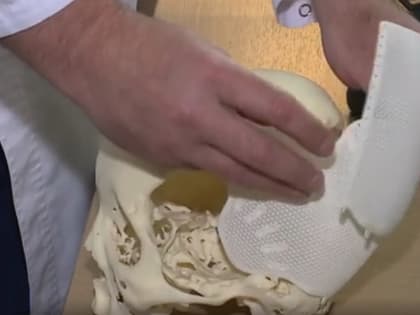 В Новосибирске врачи спасли пациентку от тромба, а затем от кровоизлияния