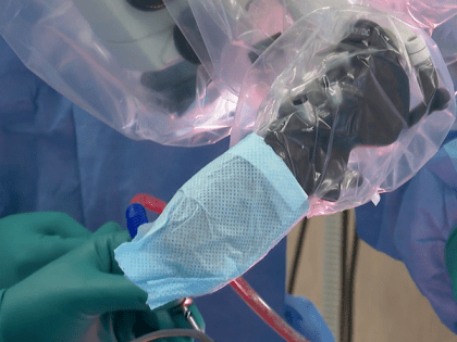 Новосибирские врачи прооперировали будущую маму с опухолью головного мозга