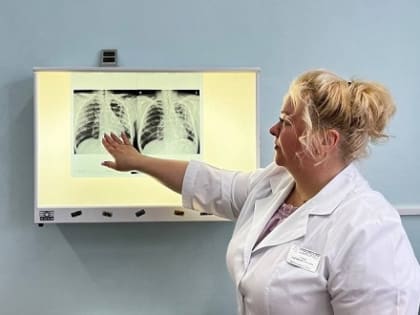 За неделю 1467 северян проверили состояние лёгких