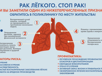 «Поймать» рак. Почему стоит бросить курить и быть внимательным к своим легким