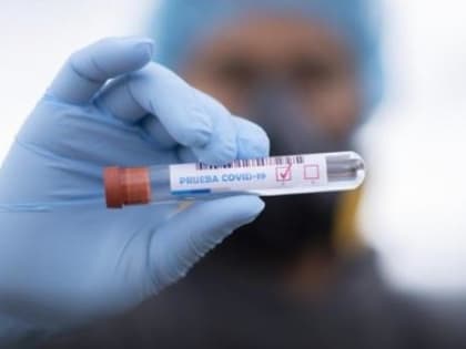 Резкое падение уровня заболеваемости ковидом фиксируют в Архангельской области