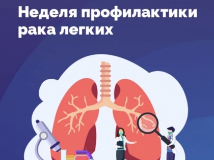 «Поймать» рак. Почему стоит бросить курить и быть внимательным к своим легким
