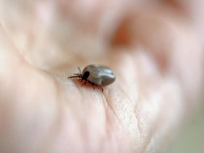 В Архангельской области уже три человека заболели клещевым энцефалитом