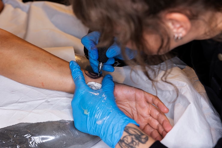 Tattoo Removal