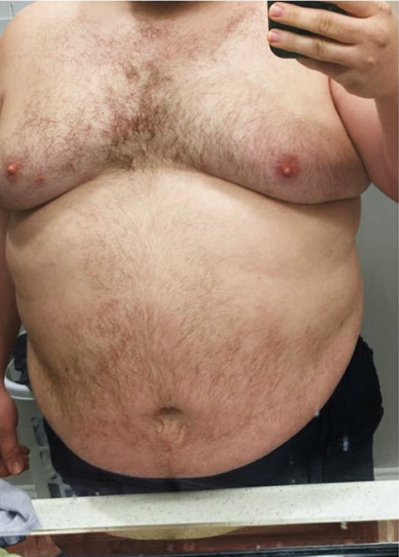 Client before transformation