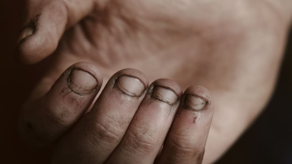 Austin Parsons bor med sin kone og tre døtre i et dejligt hus i byen Madison, West Virginia. En stor del af familiens velstand kommer fra kulminearbejde.