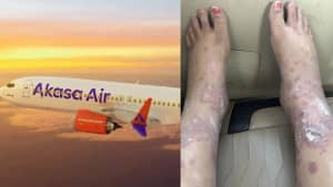 Akasa Air Flight Hygiene Allegation Sparks Passenger Health Crisis After Bengaluru Departure