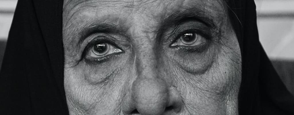 There are five noses in the picture.