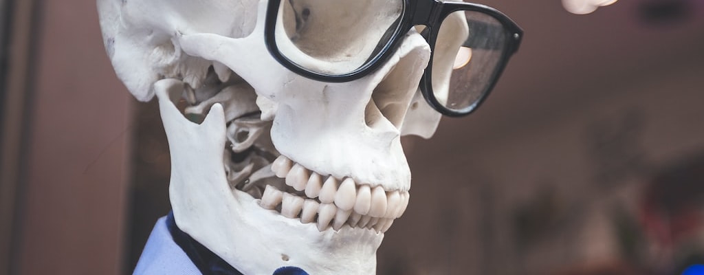 That joke was a knee slapper!