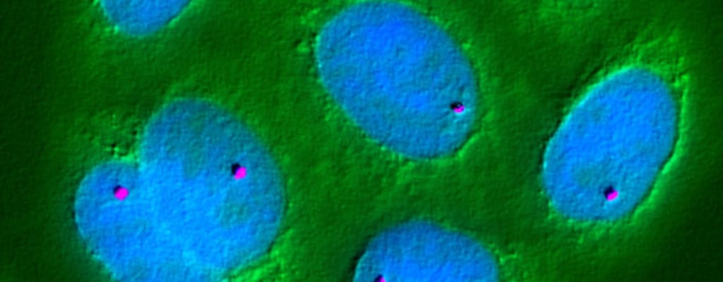 Genetics and luck play a role in inheritance variability.