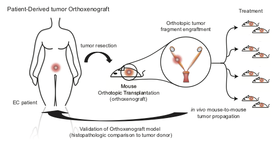 Generation of EC orthoxenografts. Schematic representation of patient-derived orthoxenotransplant implants procedure and treatment used in Eritja et al. Autophagy 2017. EEC tumors were surgically removed and small pieces were implanted in the uterus of recipient female mice. Once engrafted, tumors were propagated to a cohort of 20–45 mice, randomized and treated accordingly.