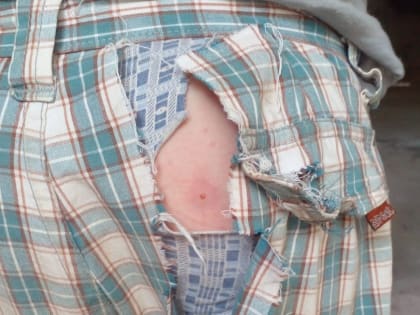 Под Астраханью собака напала на маленького ребенка