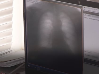 Астраханцы старше 15 лет смогут проверить здоровье в передвижном флюорографе