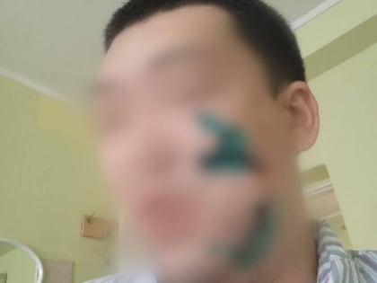 Астраханцу в кафе «Гранат» порезали лицо стаканом за оскорбление посетительницы