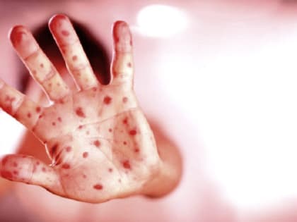 Севастополь выгодно отличается от большинства регионов России