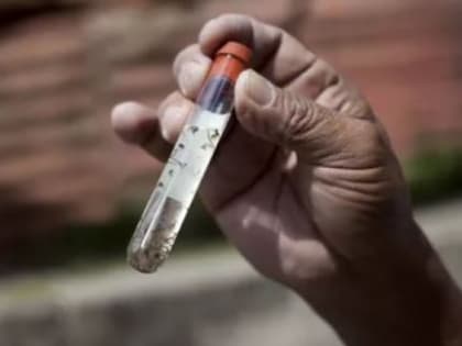 Россиян предупредили о рисках заражения вирусом Зика при поездках за рубеж