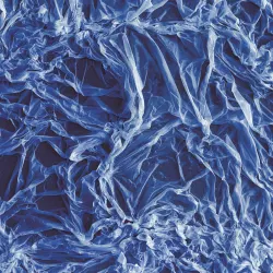 close up of Twisted - by Izabel Lind