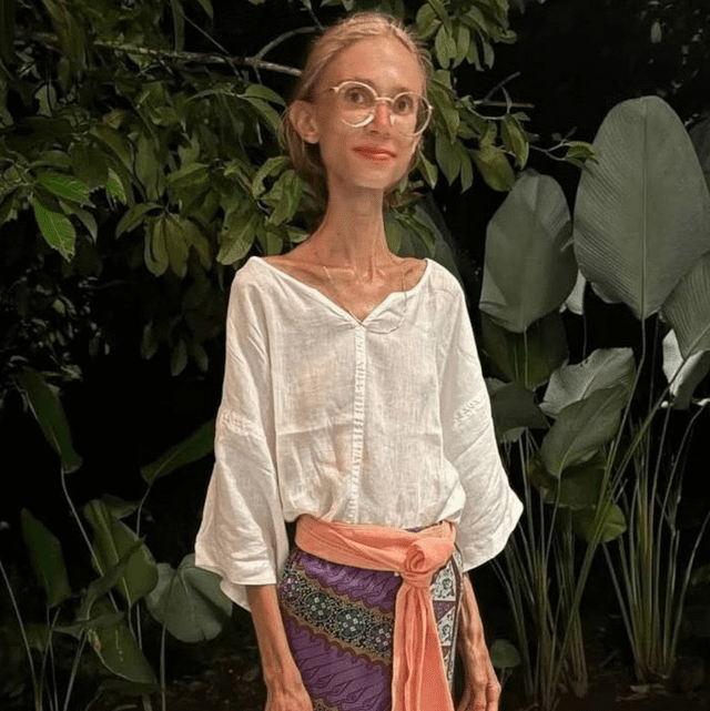 Last Image of Karolina Krzyzak at the Sumberkima Hill Resort in Bali, Indonesia in December 2024. On January 1 2025, she was found dead in her room by resort staff. Her cause of death was severe malnutrition from the vegan fruitarian diet she adopted as a path to spiritual and physical health.