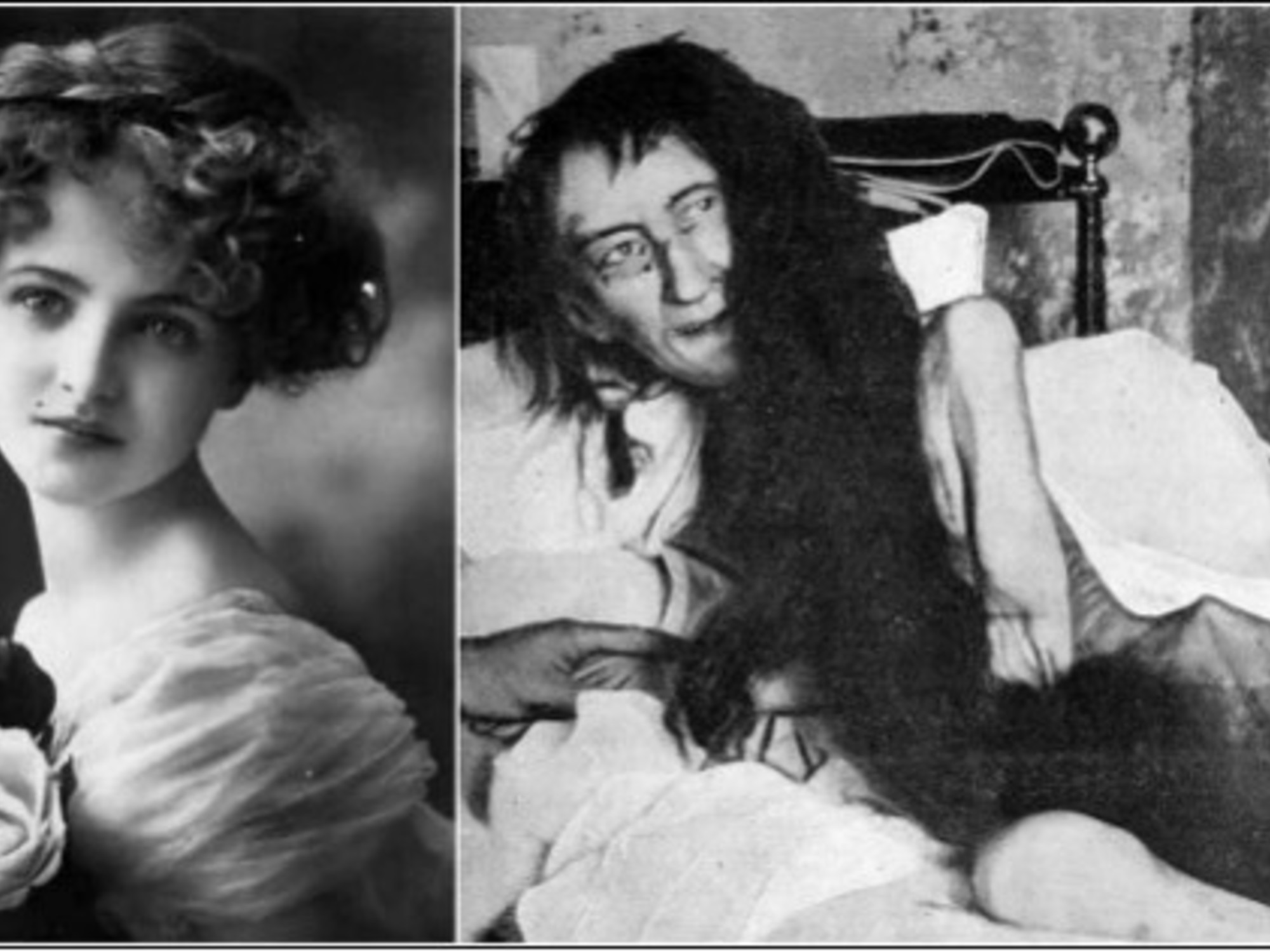 El caso de Blanche Monnier: una mujer encerrada por su familia durante 25 años