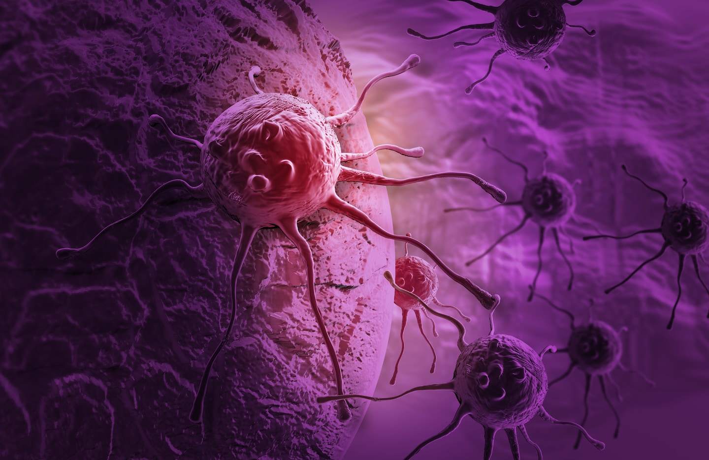 Clinical trial shows pancreatic cancer drug significantly extends survival compared to chemotherapy