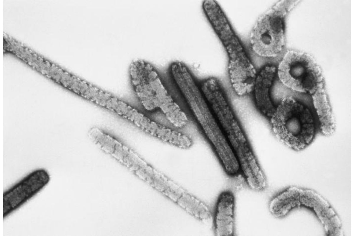 Uganda reports isolated Marburg virus case detected during surveillance, Africa CDC confirms