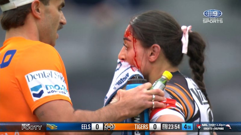 Wests Tigers Hooker Suffering After Head Collision With Teammate