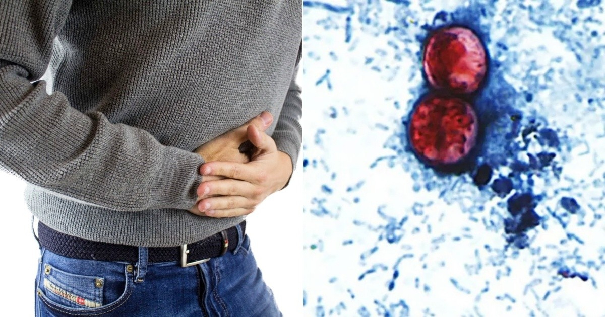 Investigan posible origen del brote de ciclosporiasis en Florida y 30 estados de EE.UU.