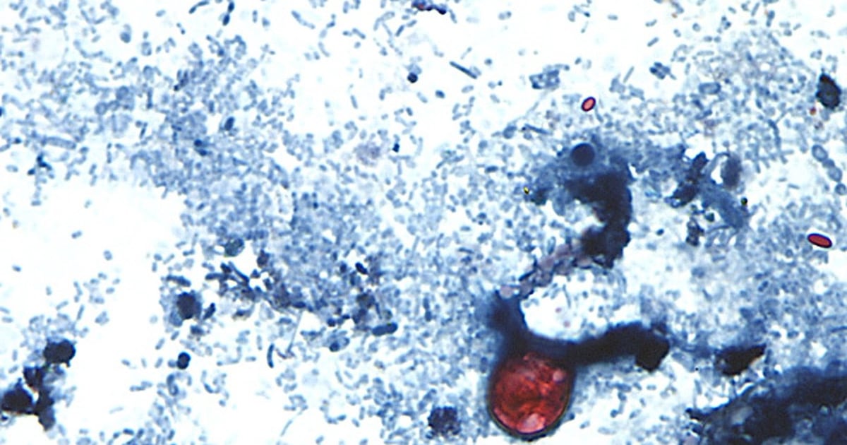 Quebec warns of rising cyclosporiasis cases linked to contaminated food and water