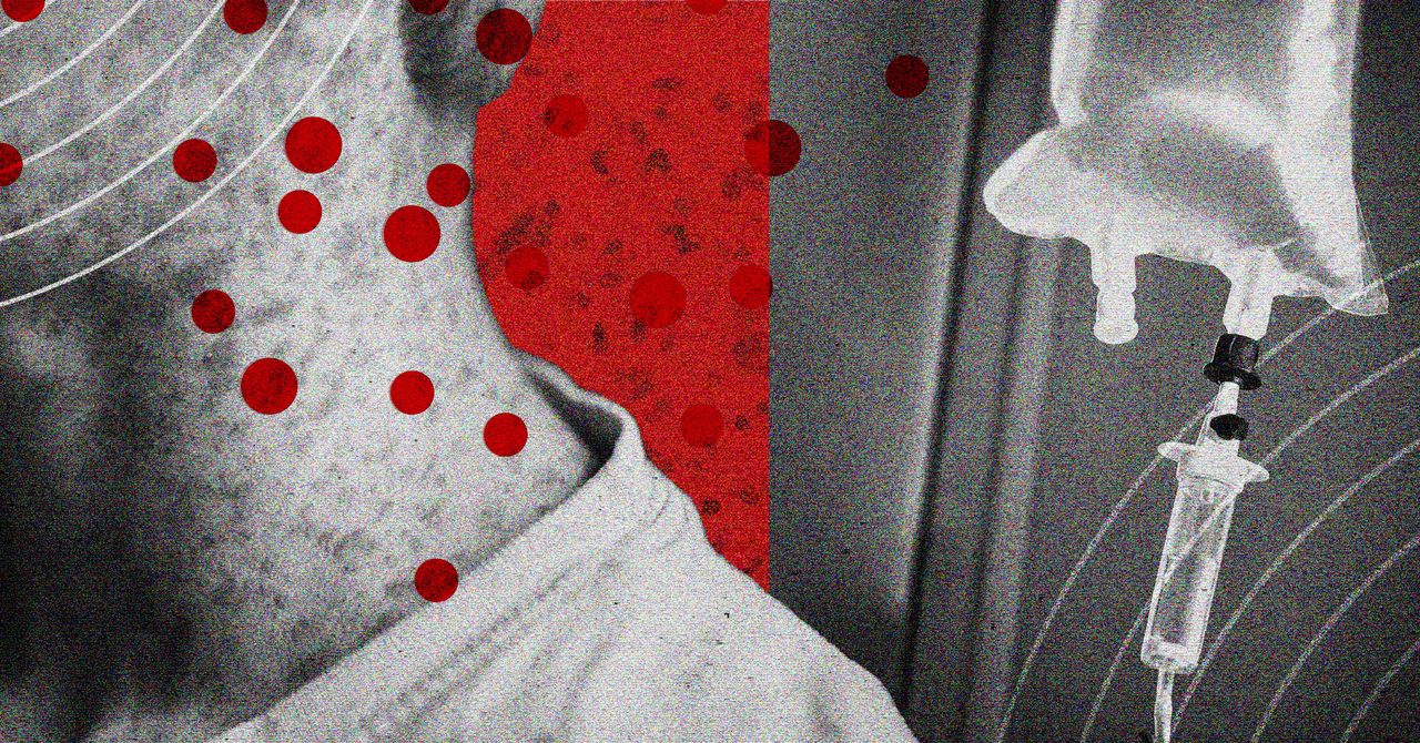 Rising Measles Cases Prompt Development of New Treatments