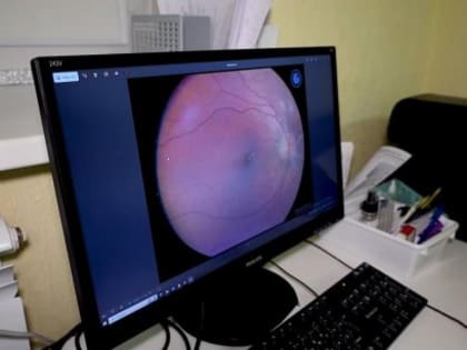 Поликлиники Ленска пополнились новым офтальмологическим оборудованием