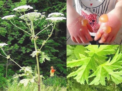 Борщевик - зеленая угроза. Как защитить себя от опасного растения?