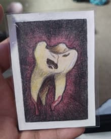 Small Tooth Decay