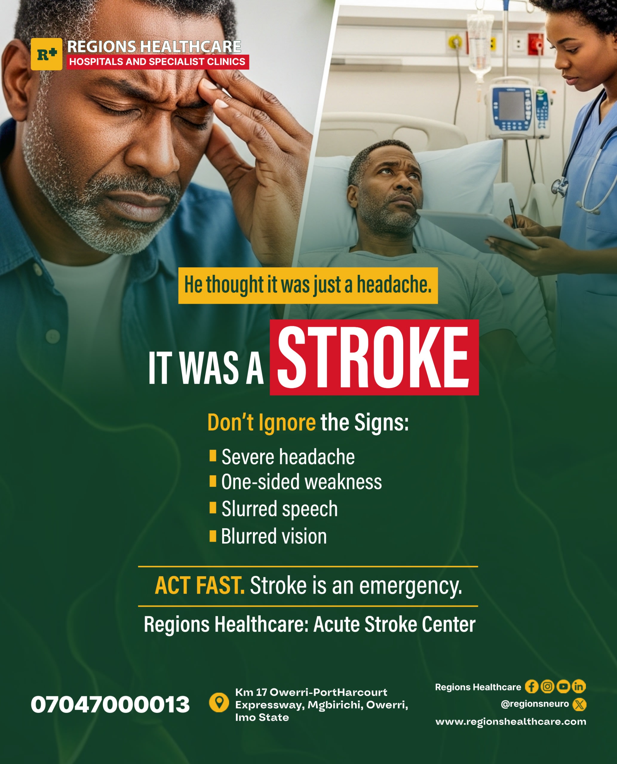 Early Signs of Stroke Nigerians Ignore: What You Need to Know Before It’s Too Late