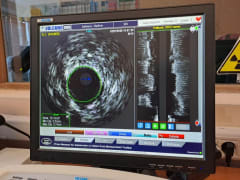 Региональный сосудистый центр НГКБ оснастили современным оборудованием