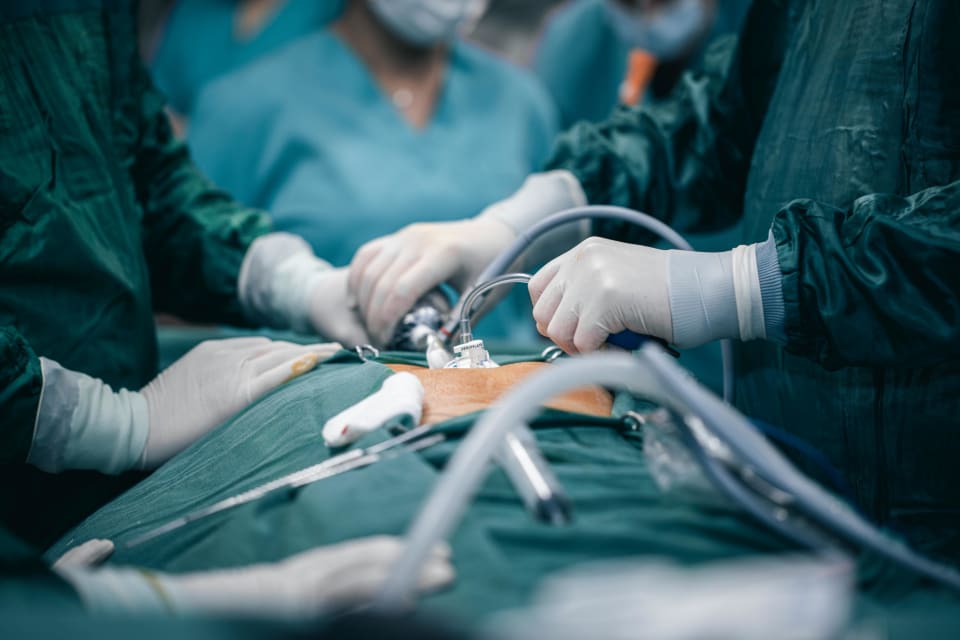 Laparoscopic Surgery