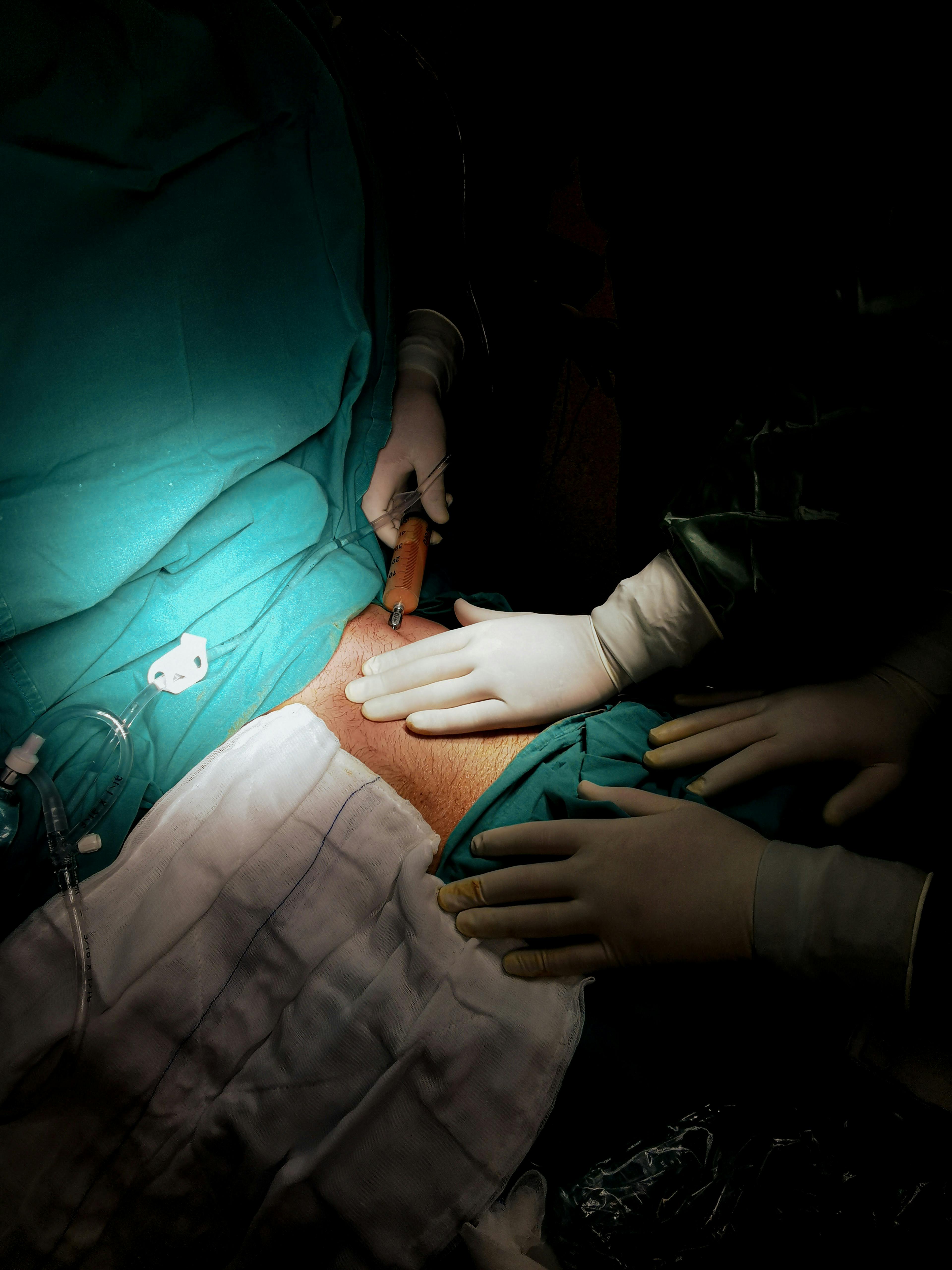 Laparoscopic Surgery image 1